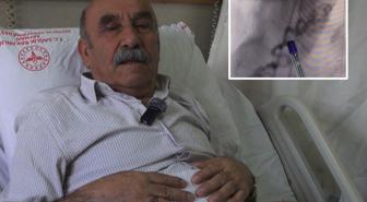 Hastanın kalbine giden kanı akciğere yönlendiren 'anormal damar' operasyonla kapatıldı