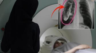 Hastaya 'Göğsünde canlı böcek var' dendi, gerçek çok başka çıktı