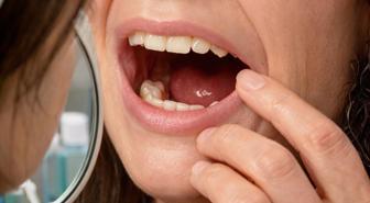 Sabah uyandığında dişleri yoktu! Doktorları bile şaşırtan gerçek hastaneye ortaya çıktı