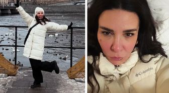 Ünlü şarkıcı Fatma Turgut'un yüzü soğuktan bu hale geldi