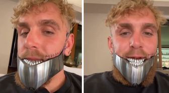 Bir maçla 92 milyon dolar kazanmıştı! Çenesi kırılan Jake Paul ikinci kez ameliyat oldu