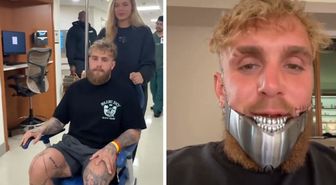 Bir maçla 92 milyon dolar kazanmıştı! Çenesi kırılan Jake Paul ikinci kez ameliyat oldu