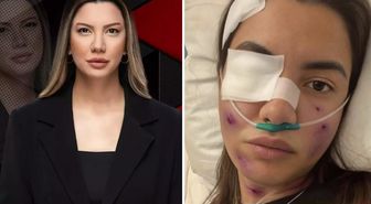 Fulya Öztürk trafik kazası mı geçirdi? Elden ele dolaşan görselle ilgili açıklama var
