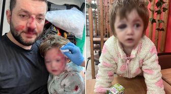İşte 14 aylık İkra bebeği hastanelik edenlere istenen ceza! Skuter silah sayıldı