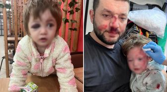İşte 14 aylık İkra bebeği hastanelik edenlere istenen ceza! Skuter silah sayıldı
