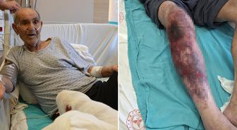 Herkesin başına gelebilir! Tıkalı lavaboyu açmak isterken yandı