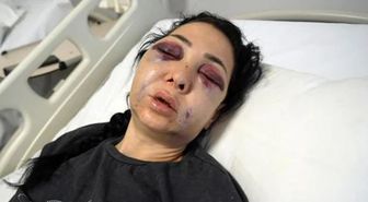 Oğlunun gözü önünde anneyi öldüresiye dövdüler: Küfür etmeyin dedik diye bu hale geldim