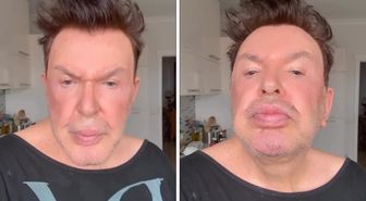 Kuşum Aydın estetik sonrası son halini paylaştı! Değişimi gündem oldu
