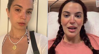 Ameliyat hatası hayatına mal oluyordu! Aslı Bekiroğlu: Ölümden döndüm