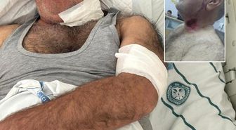 Severek beslediği hayvan bu hale getirdi