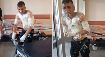 Engelli vatandaşı benzin döküp yakan vicdansıza verilen ceza belli oldu