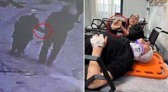 Hastanede bile birbirlerinin ellerini bırakmadılar