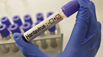 Hantavirüs grip gibi başlıyor! İşte en ayırt edici belirtisi