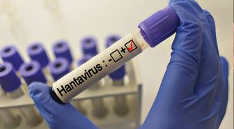 Hantavirüs grip gibi başlıyor! Bu belirtiler varsa aman dikkat