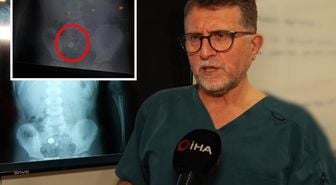 Şeker sanıp yuttu, pil olduğu filmde ortaya çıktı: Ölüme kadar götürebiliyor