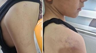 Babasının, öğretmeninden harçlık istedi diye darbettiği çocuk devlet korumasına alındı