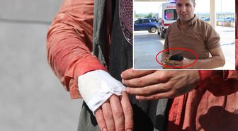 '13 dakikada kurbanı keserim' diyen acemi kasap kendini kesti