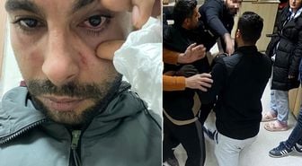 Hastasına yumruk atan doktora dava