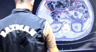 Şüpheli hareketleri ele verdi! Midesinden çıkanlar şaşkına çevirdi