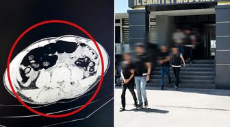 Batman’da akıllara durgunluk veren olay: Yolcu otobüsünde yakalanan 4 şüphelinin midesinden kilo kilo uyuşturucu çıktı