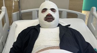 Hararet yapan araca acele müdahale ikinci derece yanığa neden oldu