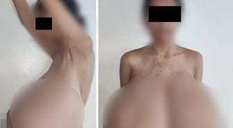 13 yaşında başladı! Göğüsleri vücut ağırlığının dörtte birine ulaştı