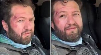Fenomen Ömer Başdoğan motosiklet kazası geçirdi
