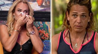 Survivor Nagihan zor anlar yaşadı! 750 bin TL'lik estetiğini anlattı