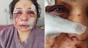 Polis memuru kocasının öldüresiye dövdüğü kadına hapis şoku
