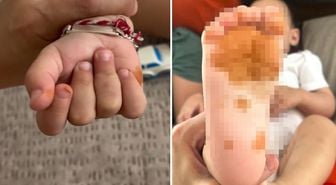 Olay Türkiye'de yaşandı! Sabah uyandığında çocuğunun eline ayağına bakan anne şoke oldu