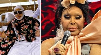 Bülent Ersoy’un lolita estetiği sonrası son hali: Bana abla demeyin