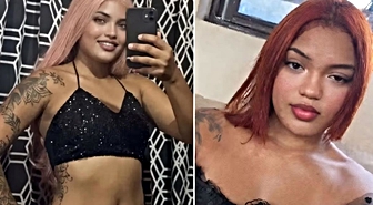 21 yaşındaki anne yanmış halde bulundu! Ölmeden önce söyledikleri ürpertti