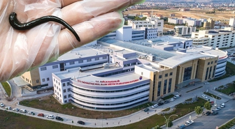 Çorum'da hastanın boğazından canlı sülük çıkarıldı! Köy çeşmesinden su içmiş