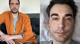 Fıtık ameliyatı hayatını kararttı: Fransız oyuncu Arnaud Denis ötanazi ile can verdi