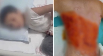 12 yaşındaki çocuğu diri diri yaktılar! Sonrası daha da korkunç