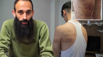 15 yaşındaki çırağa işkencede yeni gelişme! Yeniden gözaltına alınan cani berber tutuklandı