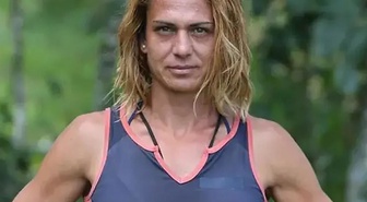 Estetik sonrası paylaşım! Survivor Nagihan Karadere’nin son hali