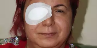 Alerji olan kadının derisi döküldü, sağ gözü görme kaybı yaşadı