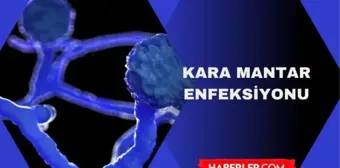 Kara mantar hastalığı bulaşıcı mı? Kara mantar enfeksiyonu nedir? Kara mantar hastalığı nasıl bulaşır?