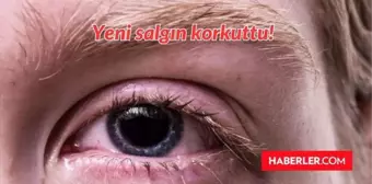 Kırmızı Göz hastalığı nedir, tedavisi var mı? Pakistan'da çıkan yeni virüs, salgın ne?