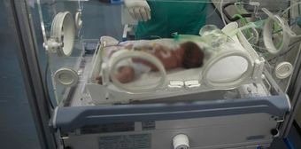 Hastanede 47 gün kalan bebek ailesine kırık ayak ve kafasında morluklarla teslim edildi
