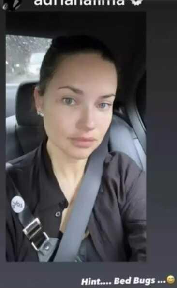 Adriana Lima'yı tahta kurusu mu ısırdı, sağlık durumu nasıl? Adriana Lima'nın son hali!