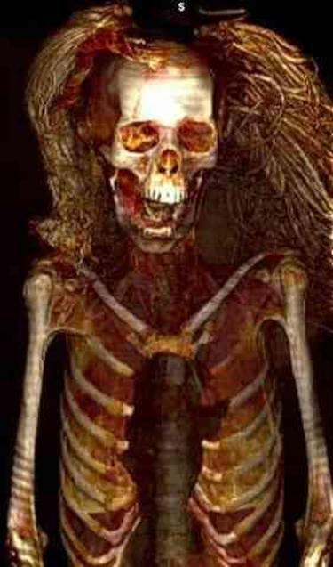 Bilim adamları, 3.500 yıl önce yaşamış 'Çığlık atan kadın' mumyası, bilim adamlarını şaşırttı