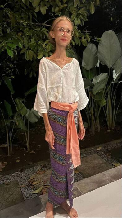 Uyguladığı diyet sonu oldu! 22 kiloya düşen ünlü fenomen hayatını kaybetti