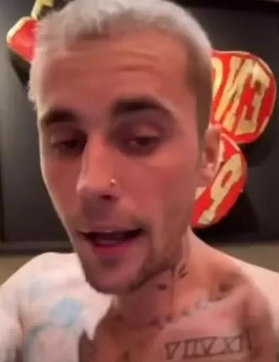 Justin Bieber kabus dolu günler yaşıyor! Eşi dua istedi