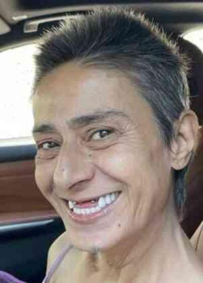 Yıldız Tilbe'nin dişleri neden yok? Yıldız Tilbe'in dişsiz pozu olay oldu!