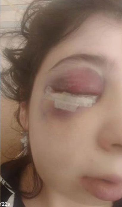Samsun'da Tacizci Sanık Tahliye Edildi