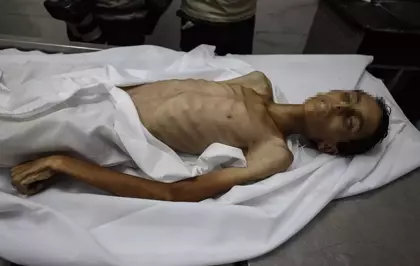 Gazze'de Açlık Politikası: 17 Yaşındaki Filistinli Çocuk Hayatını Kaybetti