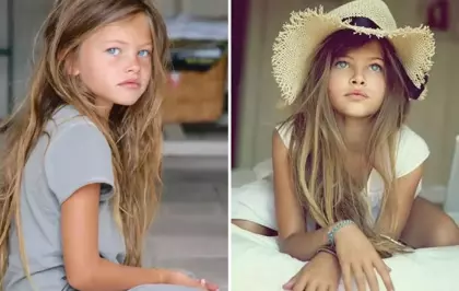 'Dünyanın en güzel kızı' seçilmişti! Son haline gelen yorumlara ateş püskürdü