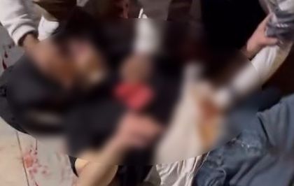 Ankara'da metro istasyonu çıkışında bıçaklı kavga: 2 yaralı